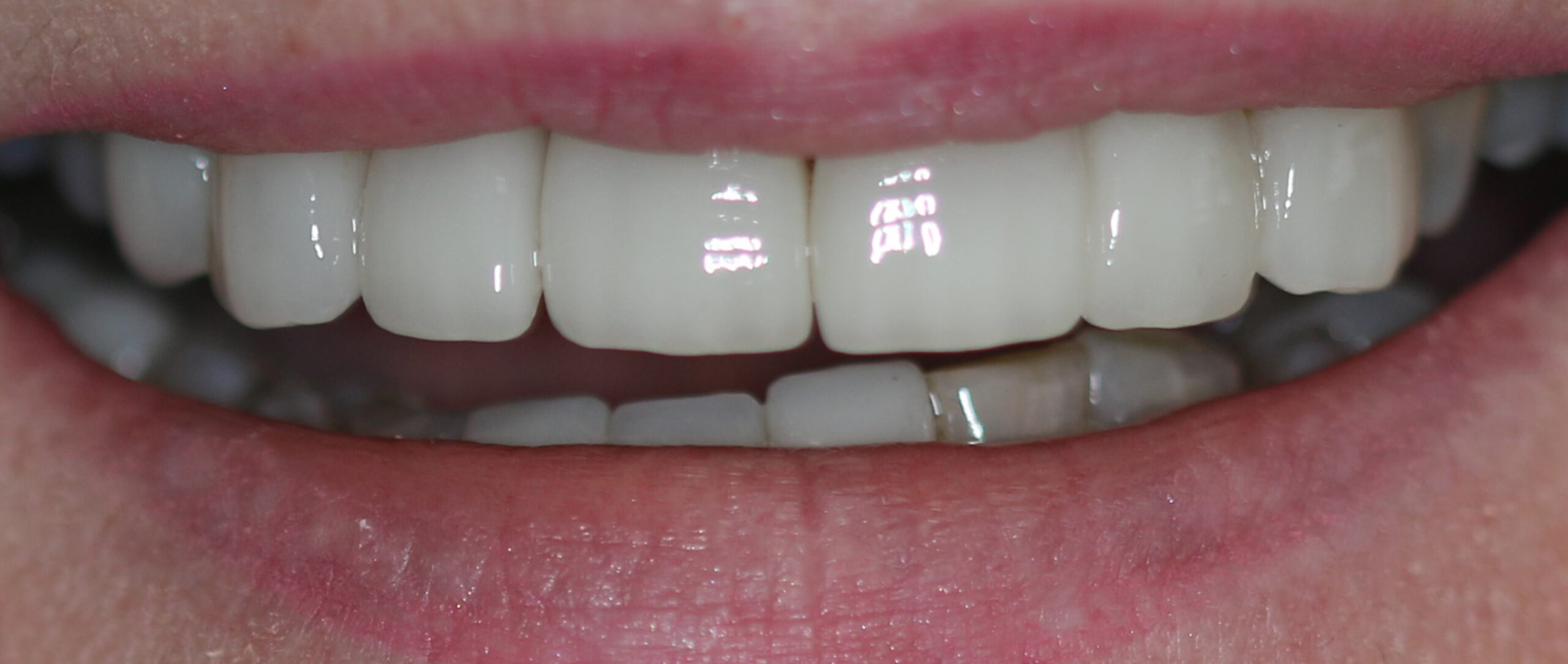 smile gallery, Smile Gallery