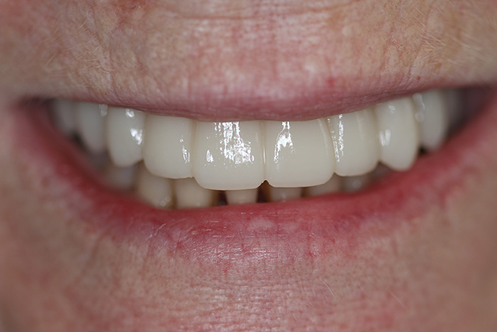 smile gallery, Smile Gallery