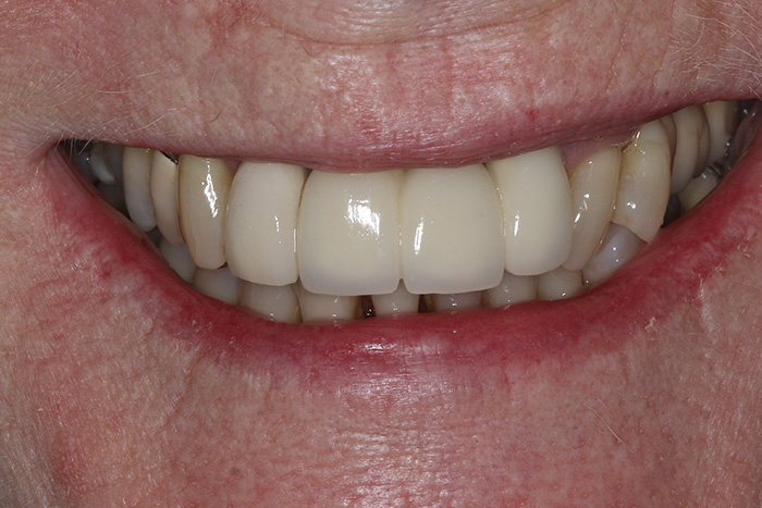 smile gallery, Smile Gallery