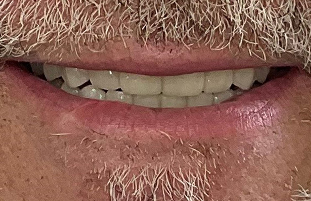 smile gallery, Smile Gallery