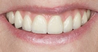 smile gallery, Smile Gallery