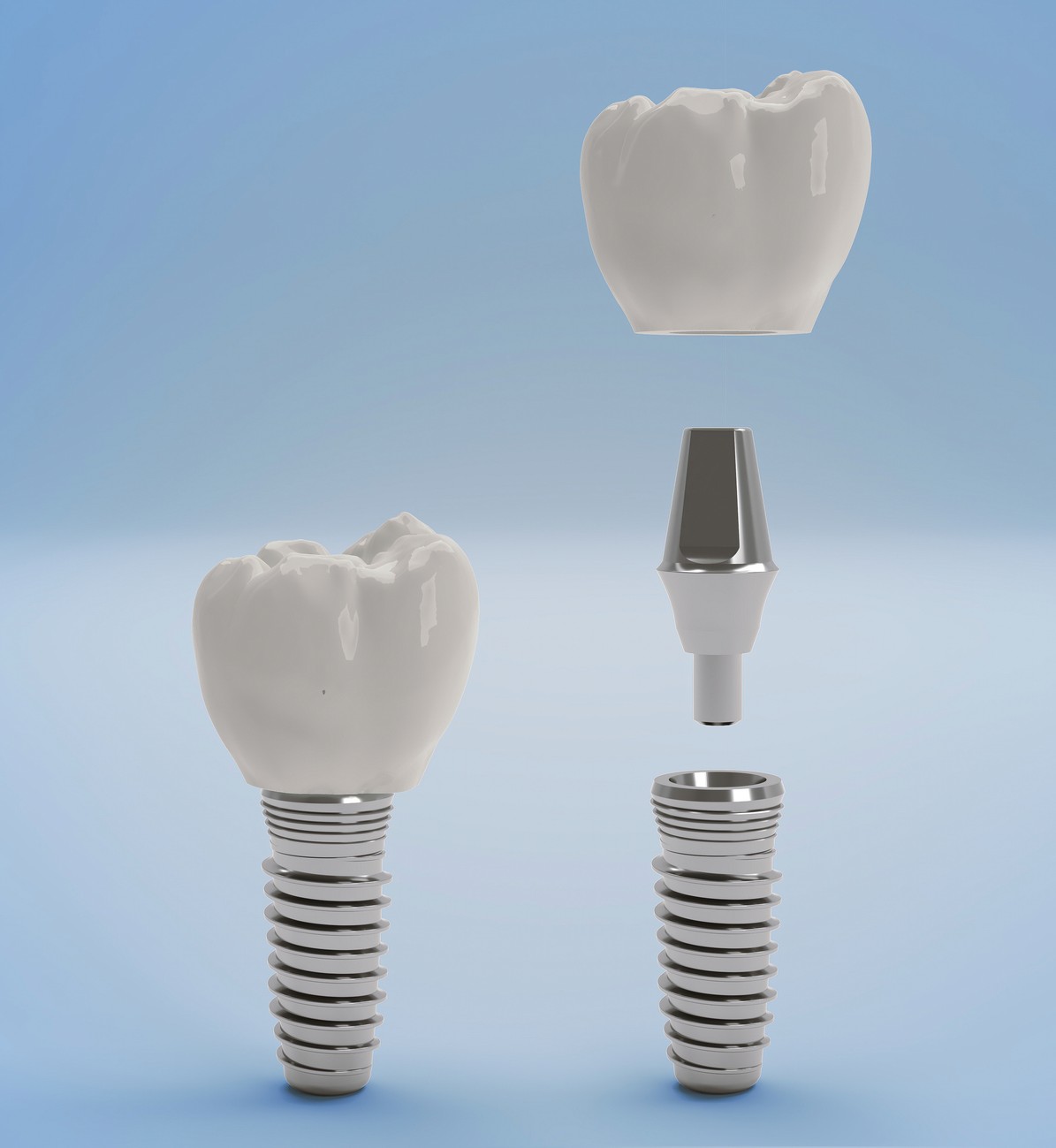, Peace of Mind with Our Dental Implant Warranty