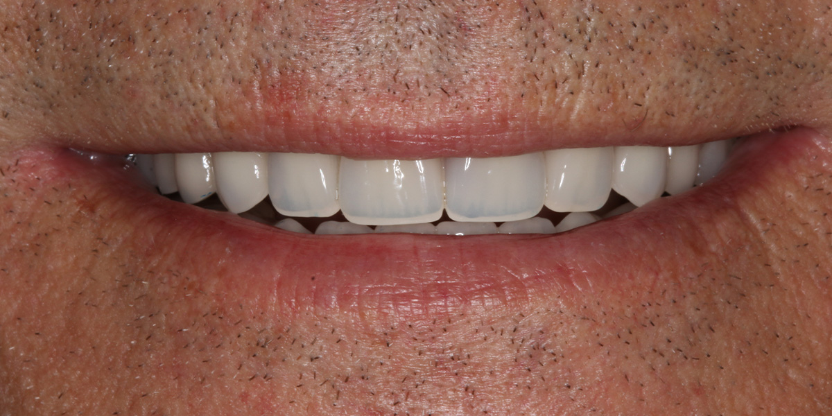 smile gallery, Smile Gallery