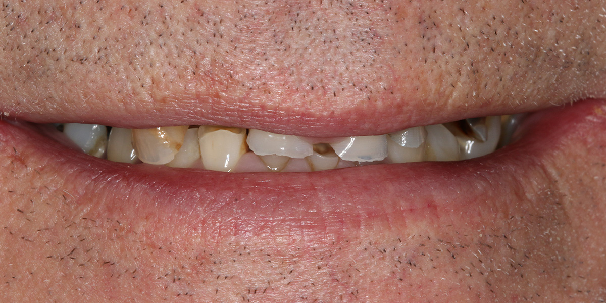 smile gallery, Smile Gallery