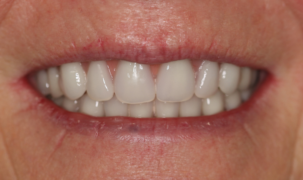 smile gallery, Smile Gallery