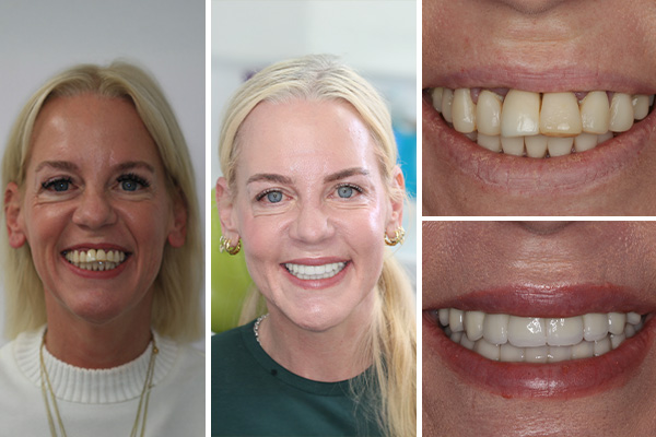 smile gallery, Smile Gallery